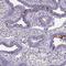 C3orf80 antibody, HPA047439, Atlas Antibodies, Immunohistochemistry paraffin image 
