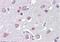 Fasciculation And Elongation Protein Zeta 1 antibody, NB100-53816, Novus Biologicals, Immunohistochemistry paraffin image 