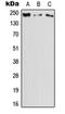 Dedicator Of Cytokinesis 11 antibody, orb215371, Biorbyt, Western Blot image 