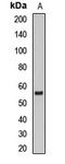 Diacylglycerol O-Acyltransferase 1 antibody, orb412499, Biorbyt, Western Blot image 