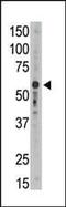 Sialic Acid Binding Ig Like Lectin 9 antibody, PA5-11683, Invitrogen Antibodies, Western Blot image 