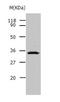 Uroplakin 3B antibody, TA322172, Origene, Western Blot image 
