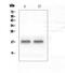 Natriuretic Peptide A antibody, PA5-79758, Invitrogen Antibodies, Western Blot image 