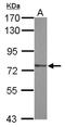 Zinc Finger X-Linked Duplicated A antibody, NBP2-21059, Novus Biologicals, Western Blot image 