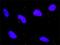 Death Associated Protein Kinase 1 antibody, H00001612-M01, Novus Biologicals, Proximity Ligation Assay image 