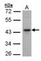 Forkhead box protein E1 antibody, NBP1-30960, Novus Biologicals, Western Blot image 