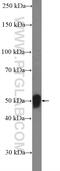 Serpin A12 antibody, 17451-1-AP, Proteintech Group, Western Blot image 