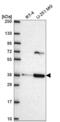 Secretory Carrier Membrane Protein 3 antibody, NBP2-56966, Novus Biologicals, Western Blot image 
