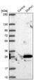 2'-Deoxynucleoside 5'-Phosphate N-Hydrolase 1 antibody, NBP1-85181, Novus Biologicals, Western Blot image 