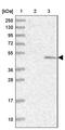 Sulfatase Modifying Factor 1 antibody, PA5-58213, Invitrogen Antibodies, Western Blot image 