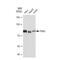 Protein Inhibitor Of Activated STAT 1 antibody, GTX03235, GeneTex, Western Blot image 
