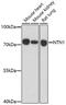 Netrin 1 antibody, 16-506, ProSci, Western Blot image 