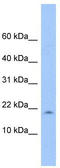 LOC285033 antibody, TA334970, Origene, Western Blot image 