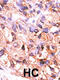 Protein Phosphatase, Mg2+/Mn2+ Dependent 1F antibody, 63-482, ProSci, Immunohistochemistry paraffin image 
