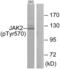 Janus Kinase 2 antibody, abx012442, Abbexa, Western Blot image 