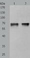 Protein Kinase C antibody, TA321516, Origene, Western Blot image 