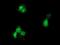 Glucokinase regulatory protein antibody, NBP2-03396, Novus Biologicals, Immunocytochemistry image 