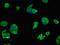 Chromosome 6 Open Reading Frame 223 antibody, LS-C677343, Lifespan Biosciences, Immunofluorescence image 