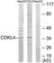 Cyclin Dependent Kinase Like 4 antibody, TA316373, Origene, Western Blot image 