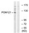 POM121 antibody, AP33272PU-N, Origene, Western Blot image 