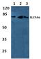 Solute Carrier Family 9 Member A6 antibody, PA5-36997, Invitrogen Antibodies, Western Blot image 