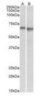 Protein Kinase AMP-Activated Catalytic Subunit Alpha 2 antibody, orb20632, Biorbyt, Western Blot image 