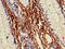 Matrix Metallopeptidase 13 antibody, A55291-100, Epigentek, Immunohistochemistry paraffin image 