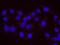 Baculoviral IAP Repeat Containing 6 antibody, NB300-264, Novus Biologicals, Proximity Ligation Assay image 
