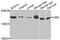 Lens Intrinsic Membrane Protein 2 antibody, A06483, Boster Biological Technology, Western Blot image 