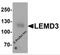 LEM Domain Containing 3 antibody, 6603, ProSci, Western Blot image 