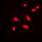 Ubiquitin carboxyl-terminal hydrolase BAP1 antibody, orb377945, Biorbyt, Immunofluorescence image 