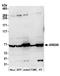 Protein III antibody, A305-310A, Bethyl Labs, Western Blot image 