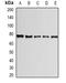Pre-MRNA Processing Factor 3 antibody, orb340923, Biorbyt, Western Blot image 
