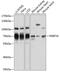 FKBP Prolyl Isomerase 10 antibody, GTX66140, GeneTex, Western Blot image 