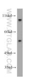 Microspherule Protein 1 antibody, 60215-1-Ig, Proteintech Group, Western Blot image 