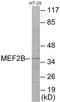Myocyte Enhancer Factor 2B antibody, EKC1769, Boster Biological Technology, Western Blot image 