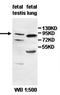 Protocadherin Beta 7 antibody, orb77880, Biorbyt, Western Blot image 