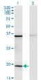Ribosomal Protein L17 antibody, LS-C198108, Lifespan Biosciences, Western Blot image 