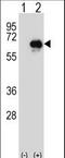Cholesteryl Ester Transfer Protein antibody, LS-C100641, Lifespan Biosciences, Western Blot image 