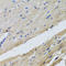 Ferrochelatase, mitochondrial antibody, A05156, Boster Biological Technology, Immunohistochemistry paraffin image 