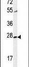CWC15 Spliceosome Associated Protein Homolog antibody, PA5-24738, Invitrogen Antibodies, Western Blot image 