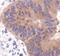 Acetyl-CoA Carboxylase Alpha antibody, PA5-17564, Invitrogen Antibodies, Immunohistochemistry paraffin image 