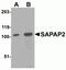 DLG Associated Protein 2 antibody, NBP2-82086, Novus Biologicals, Western Blot image 