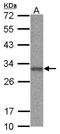 ANP32B antibody, GTX115437, GeneTex, Western Blot image 