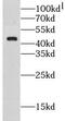 Leucine-rich repeat-containing protein 52 antibody, FNab04860, FineTest, Western Blot image 