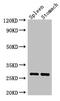 Chymotrypsinogen B1 antibody, CSB-PA324640LA01HU, Cusabio, Western Blot image 