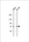 von Willebrand factor A domain-containing protein 2 antibody, PA5-48313, Invitrogen Antibodies, Western Blot image 