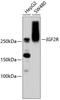 Insulin Like Growth Factor 2 Receptor antibody, 13-857, ProSci, Western Blot image 