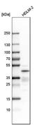 Interferon regulatory factor 4 antibody, HPA002038, Atlas Antibodies, Western Blot image 