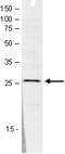 Sin3A Associated Protein 30 antibody, TA347283, Origene, Western Blot image 